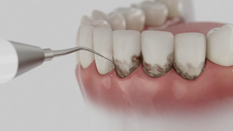 Reliable Dental contractor in Limon, CO by Dentist Open Now